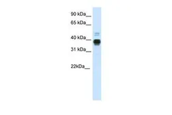 Anti-HOXA11 antibody, C-term used in Western Blot (WB). GTX48983