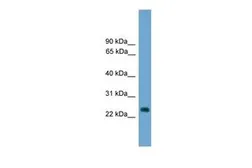 Anti-Hes7 antibody, Internal used in Western Blot (WB). GTX48997