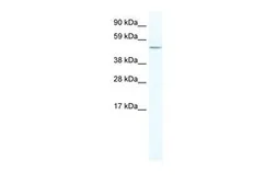 Anti-LASS4 antibody, N-term used in Western Blot (WB). GTX49079