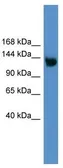 Anti-ApoER2 antibody, Internal used in Western Blot (WB). GTX49092
