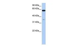 Anti-KPNA6 antibody, N-term used in Western Blot (WB). GTX49108