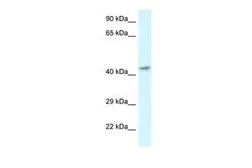Anti-MECR antibody, C-term used in Western Blot (WB). GTX49121