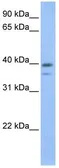Anti-VPS26B antibody used in Western Blot (WB). GTX49354