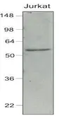 Anti-IRF7 antibody [3D9] used in Western Blot (WB). GTX50051