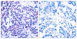 Anti-JunD (phospho Ser255) antibody used in IHC (Paraffin sections) (IHC-P). GTX50107