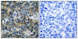 Anti-VASP (phospho Ser239) antibody used in IHC (Paraffin sections) (IHC-P). GTX50213