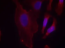 Anti-PLCG2 (phospho Tyr753) antibody used in Immunocytochemistry/ Immunofluorescence (ICC/IF). GTX50225