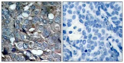 Anti-ASK1 (phospho Ser83) antibody used in IHC (Paraffin sections) (IHC-P). GTX50228