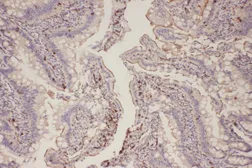 Anti-EGFR (phospho Thr654) antibody used in IHC (Paraffin sections) (IHC-P). GTX50233