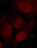 Anti-HDAC2 (phospho Ser394) antibody used in Immunocytochemistry/ Immunofluorescence (ICC/IF). GTX50236