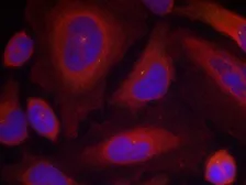 Anti-Synaptotagmin 1 (phospho Ser312) + Synaptotagmin 2 (phospho Ser309) antibody used in Immunocytochemistry/ Immunofluorescence (ICC/IF). GTX50249