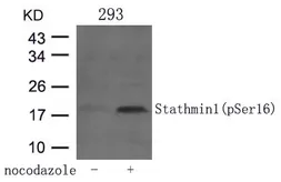 Anti-Stathmin 1 (phospho Ser16) antibody used in Western Blot (WB). GTX50269
