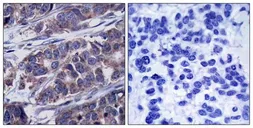 Anti-p62Dok (phospho Tyr362) antibody used in IHC (Paraffin sections) (IHC-P). GTX50297