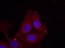 Anti-GAP43 (phospho Ser41) antibody used in Immunocytochemistry/ Immunofluorescence (ICC/IF). GTX50302