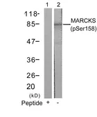 Anti-MARCKS (phospho Ser152) antibody used in Western Blot (WB). GTX50312