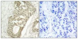 Anti-PKC delta (phospho Ser645) antibody used in IHC (Paraffin sections) (IHC-P). GTX50314