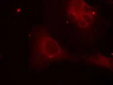 Anti-SHC1 (phospho Tyr239) antibody used in Immunocytochemistry/ Immunofluorescence (ICC/IF). GTX50325