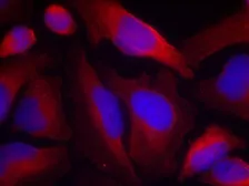 Anti-Tyrosine Hydroxylase (phospho Ser19) antibody used in Immunocytochemistry/ Immunofluorescence (ICC/IF). GTX50337