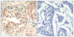 Anti-CDK6 (Phospho Tyr13) antibody used in IHC (Paraffin sections) (IHC-P). GTX50352