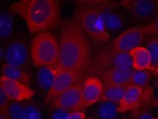 Anti-PDPK1 / PDK1 antibody used in Immunocytochemistry/ Immunofluorescence (ICC/IF). GTX50366