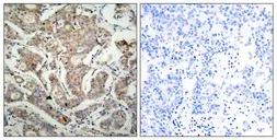 Anti-Bad antibody used in IHC (Paraffin sections) (IHC-P). GTX50417