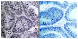 Anti-IKK alpha antibody used in IHC (Paraffin sections) (IHC-P). GTX50469