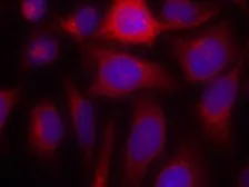 Anti-eNOS antibody used in Immunocytochemistry/ Immunofluorescence (ICC/IF). GTX50505