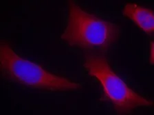 Anti-CaMKII alpha antibody used in IHC (Paraffin sections) (IHC-P). GTX50706
