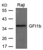 Anti-GFI1b antibody used in Western Blot (WB). GTX50844