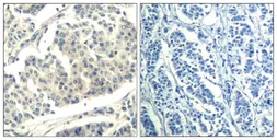 Anti-c-Abl (phospho Tyr412) antibody used in IHC (Paraffin sections) (IHC-P). GTX50859