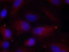 Anti-PAK1 ( phospho Thr423 ) / PAK2 ( phospho Thr402 ) / PAK3 ( phospho Thr436 ) antibody used in Immunocytochemistry/ Immunofluorescence (ICC/IF). GTX50867
