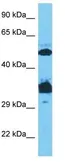 Anti-SP7 antibody, C-term used in Western Blot (WB). GTX50962