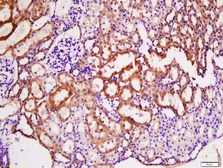 Anti-TACI antibody used in IHC (Paraffin sections) (IHC-P). GTX51554