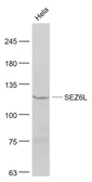 Anti-SEZ6L antibody used in Western Blot (WB). GTX51696