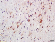 Anti-FUT8 antibody used in IHC (Paraffin sections) (IHC-P). GTX51712