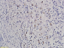 Anti-HOXB8 antibody used in IHC (Paraffin sections) (IHC-P). GTX51728