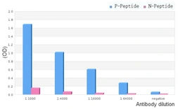 Anti-IKK alpha (phospho Ser180) + IKK beta (phospho Ser181) antibody used in  (). GTX52309