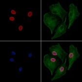 Anti-JNK antibody used in Immunocytochemistry/ Immunofluorescence (ICC/IF). GTX52360