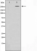 Anti-Acetyl-CoA Carboxylase 1 antibody used in Western Blot (WB). GTX52372