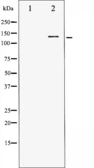 Anti-HDAC5 antibody used in Western Blot (WB). GTX52376