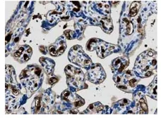 Anti-MMP13 antibody [12E10] used in IHC (Paraffin sections) (IHC-P). GTX52479
