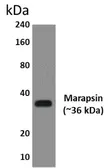 Anti-Marapsin antibody [3H15] used in Western Blot (WB). GTX52918