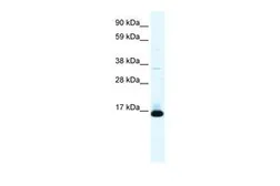 Anti-TCF21 antibody, N-term used in Western Blot (WB). GTX52981