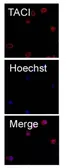 Anti-TACI antibody [9D22] used in Immunocytochemistry/ Immunofluorescence (ICC/IF). GTX53017