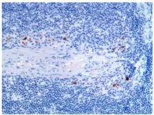 Anti-IL2 Receptor alpha antibody [MAB0710] used in IHC (Paraffin sections) (IHC-P). GTX53128