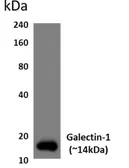 Anti-Galectin 1 antibody [9J26] used in Western Blot (WB). GTX53170