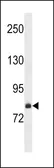 Anti-FCHSD2 antibody used in Western Blot (WB). GTX53590