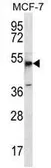 Anti-MBOAT4 antibody used in Western Blot (WB). GTX53651