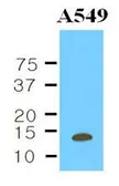 Anti-Cystatin B antibody [2F1] used in Western Blot (WB). GTX53707
