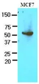 Anti-G6PD antibody [AT2F6] used in Western Blot (WB). GTX53718